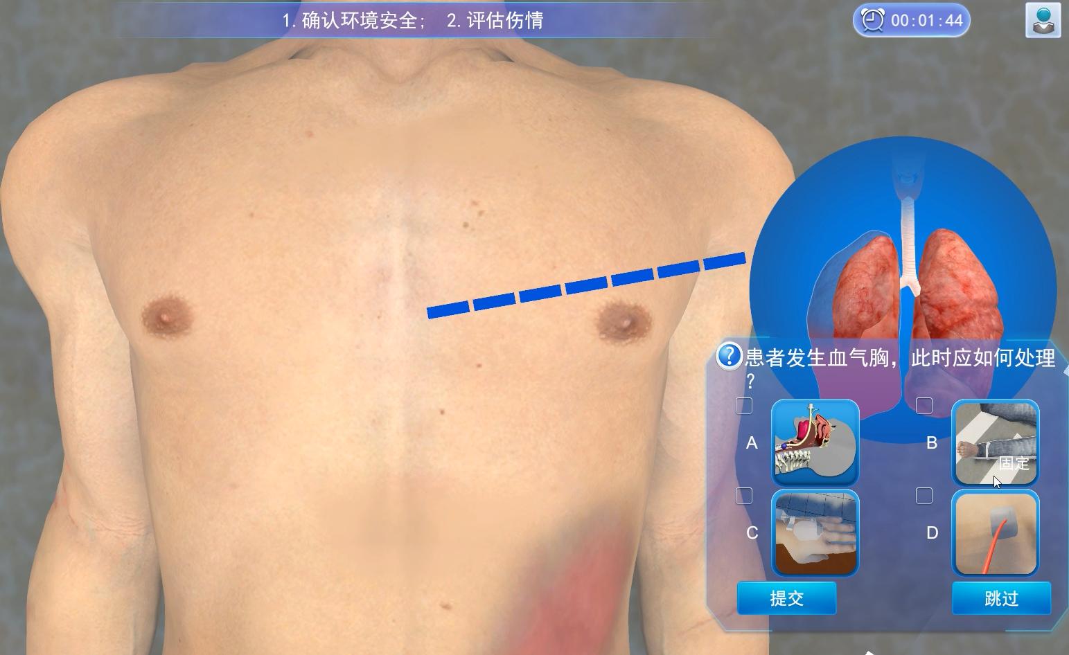 实验详情