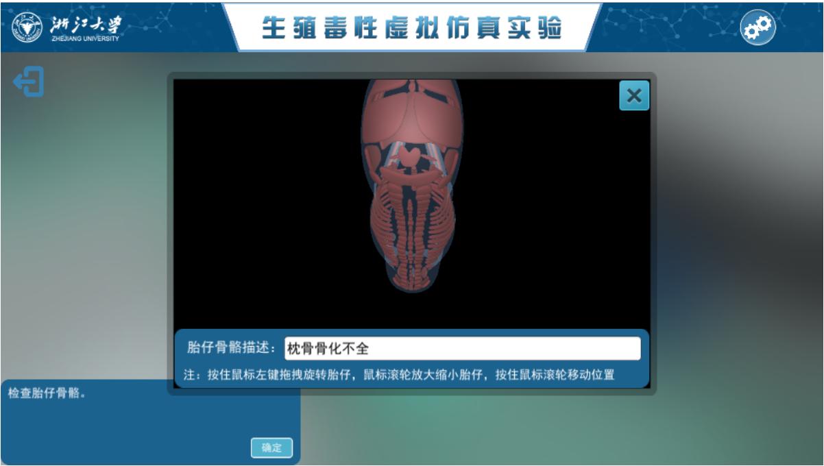 骨骼畸形.png